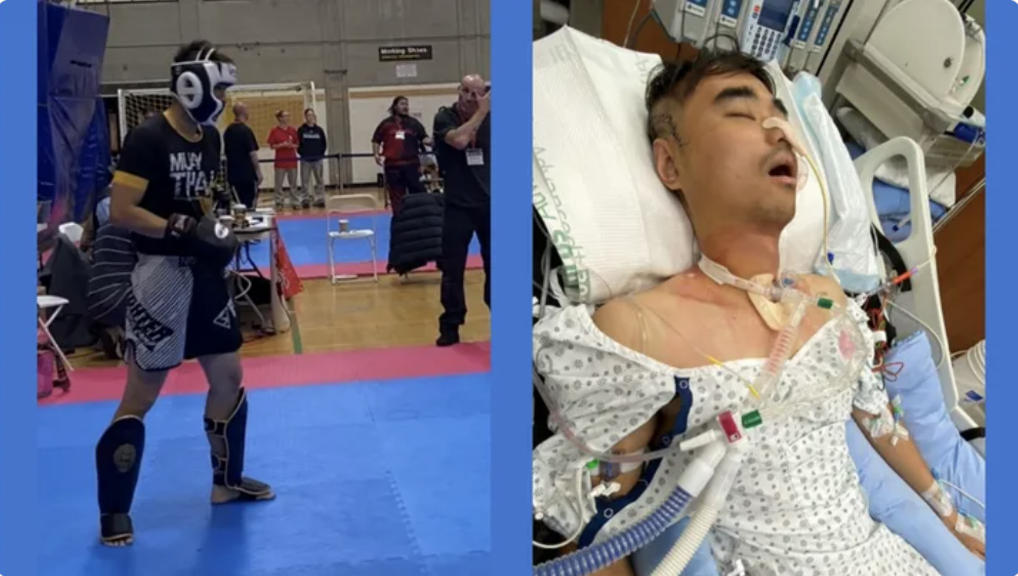 Lei Zhenhuan before and after the kickboxing event.